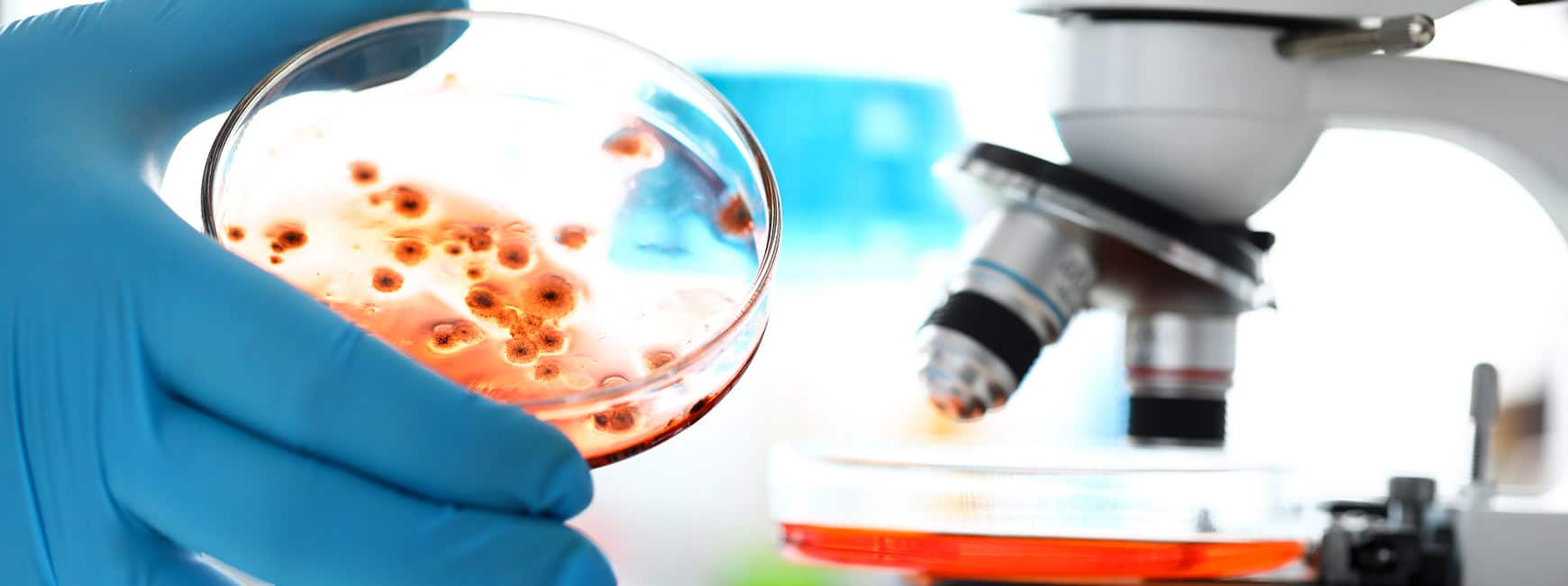 Vi tilbyder et bredt udvalg af test for både synlig og skjult skimmelsvamp. Med og uden laboratorieanalyser